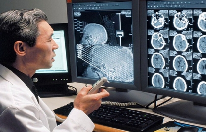 TẨY NỐT RUỒI BẰNG LASER CO2